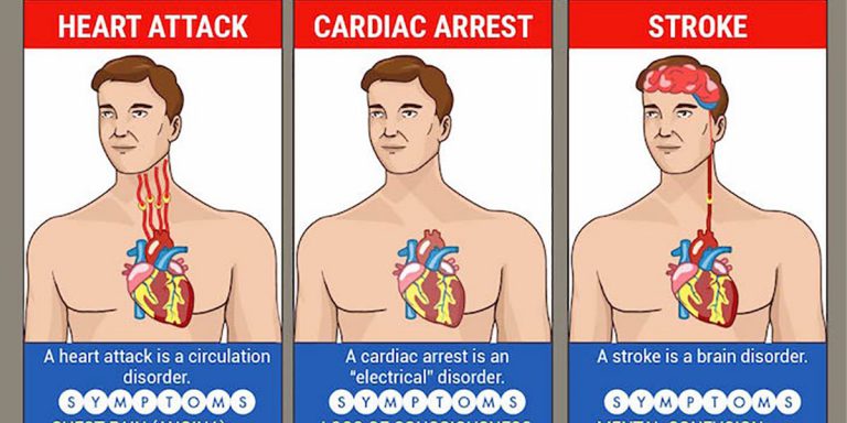 Heart Attack and Stroke – Are They Different?