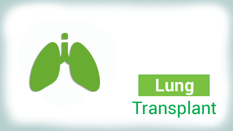 Foods to Avoid After Lung Transplant