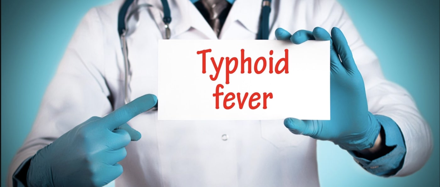 Typhoid cause, Symptoms of Typhoid and Treatment